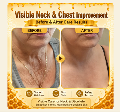 DEVIOA®   Bee Poison Skin Restoration Cream 👨‍⚕️🥇👩‍⚕️